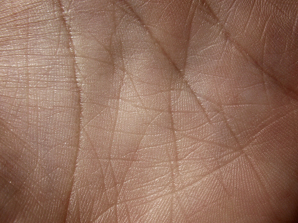 Patterns on skin